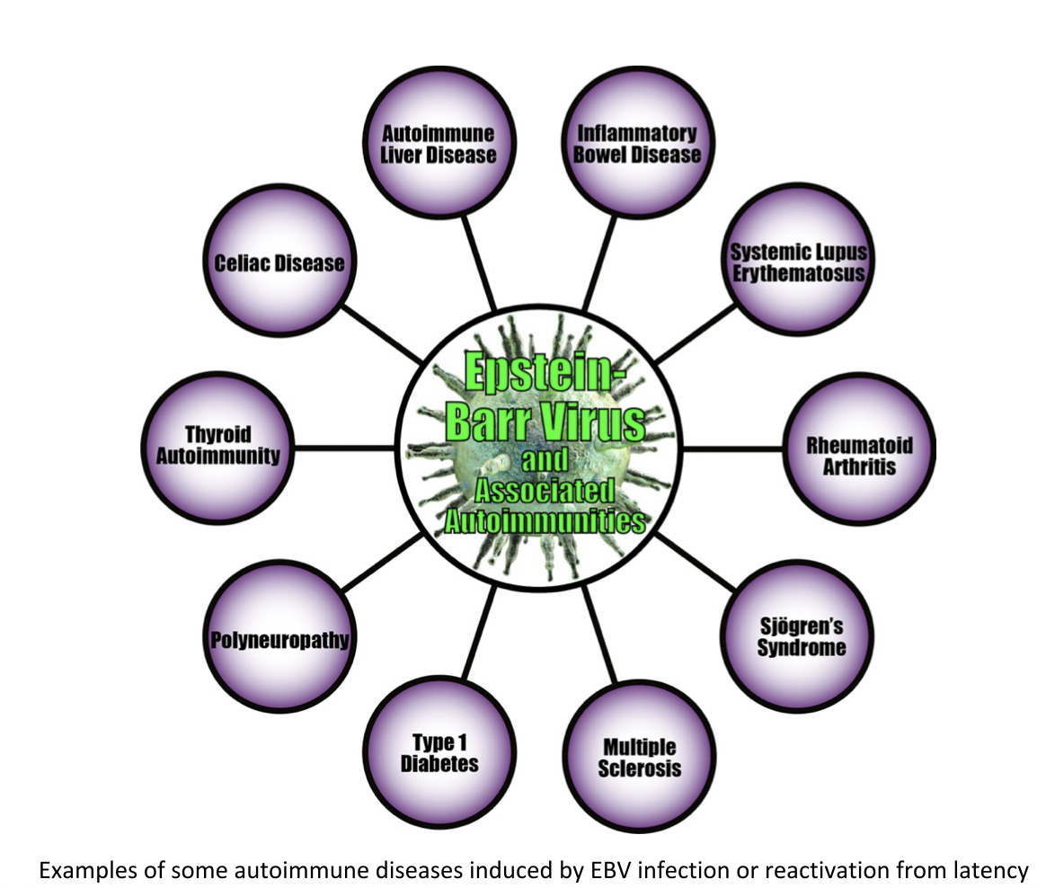 Epstein-Barr Virus (EBV) Panel by Immunosciences Lab, Inc.